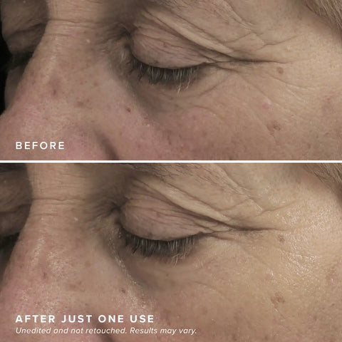 FacialRX™ Brightening Eye Masks
