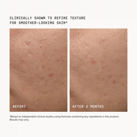 FacialRX™ Duo