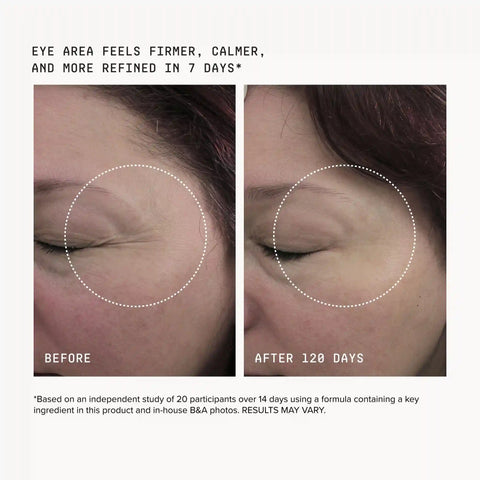 HPR Eye Cream