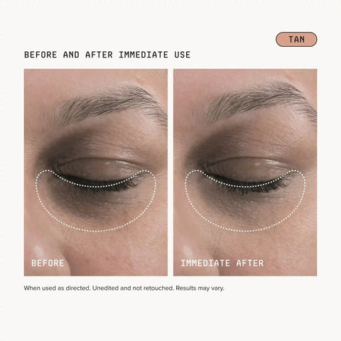 Dark Circles Bundle - Tan