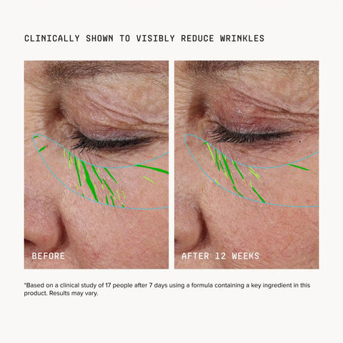 Needle-less® Growth Factor Serum